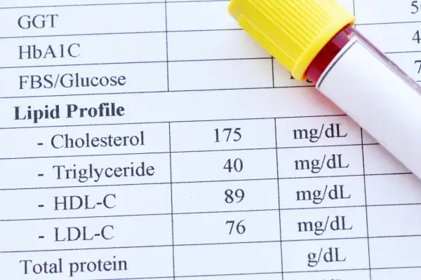 Wynik lipidogramu: cholesterol 175 mg/dL, trójglicerydy 40 mg/dL, HDL-C 89 mg/dL, LDL-C 76 mg/dL. Wysoki cholesterol całkowity może być niebezpieczny.